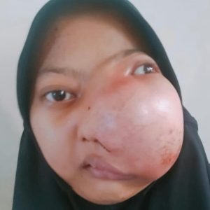 Salma Melati